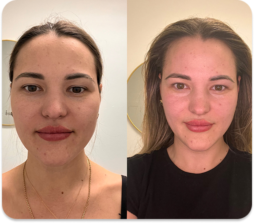 Before-and-after facial massage result from Face Bliss Academy