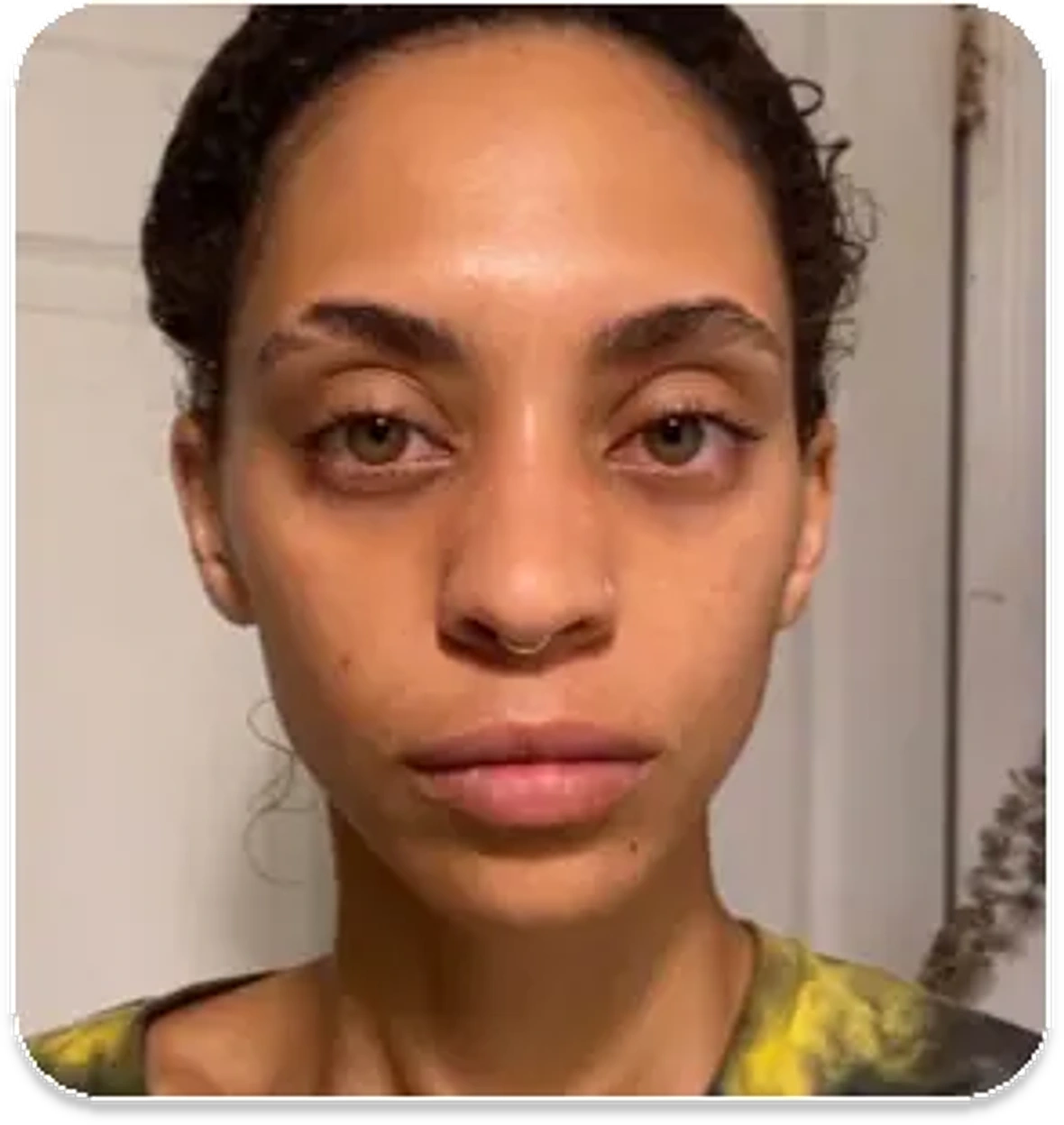 Student after practicing sculptural, lymphatic and buccal techniques